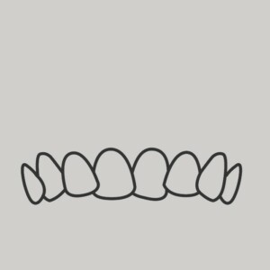 dents mal alignees
