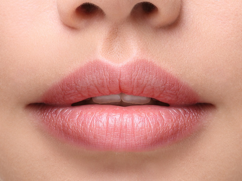 Lèvre supérieure trop longue : injection ou lifting ?