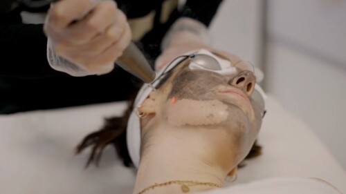 Le nouveau peeling qui buzze fort : le Hollywood Peel