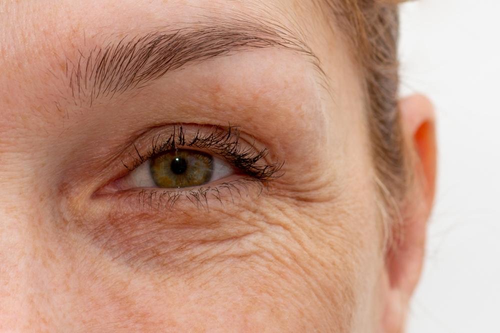 7 solutions pour traiter les paupières fripées